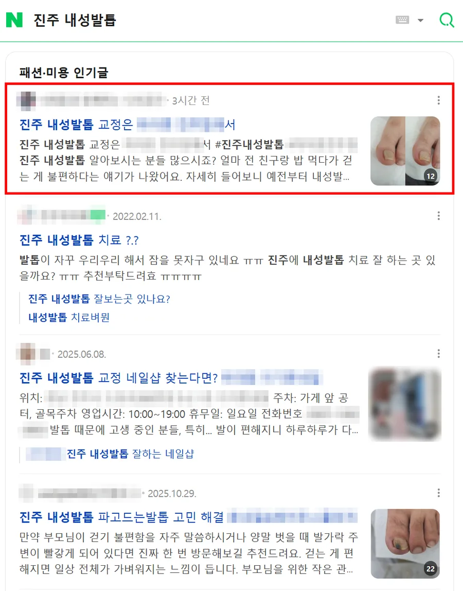 진주 내성발톱 검색결과 인기글 상단 노출 캡처